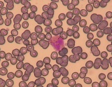 [Eosinofilní granulocyt]