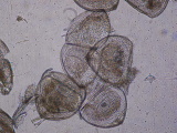 [Glochidium škeble]